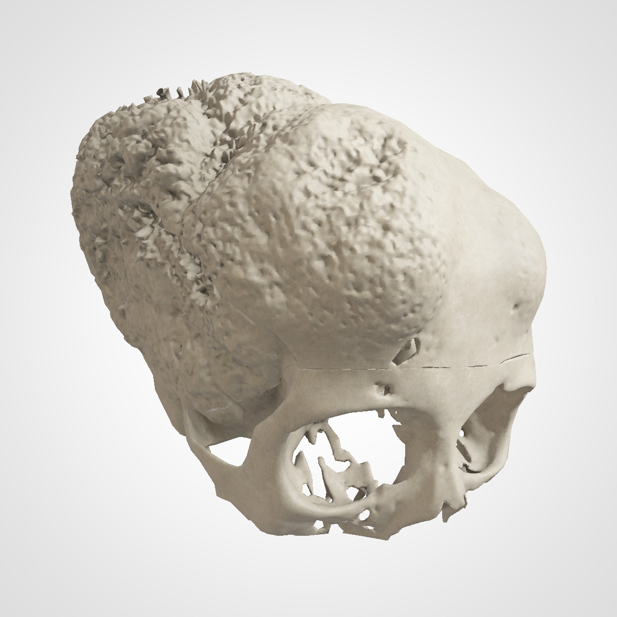 A skull with untreated defect